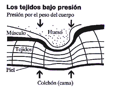 PREVENCION DE LAS LLAGAS POR CONTACTO